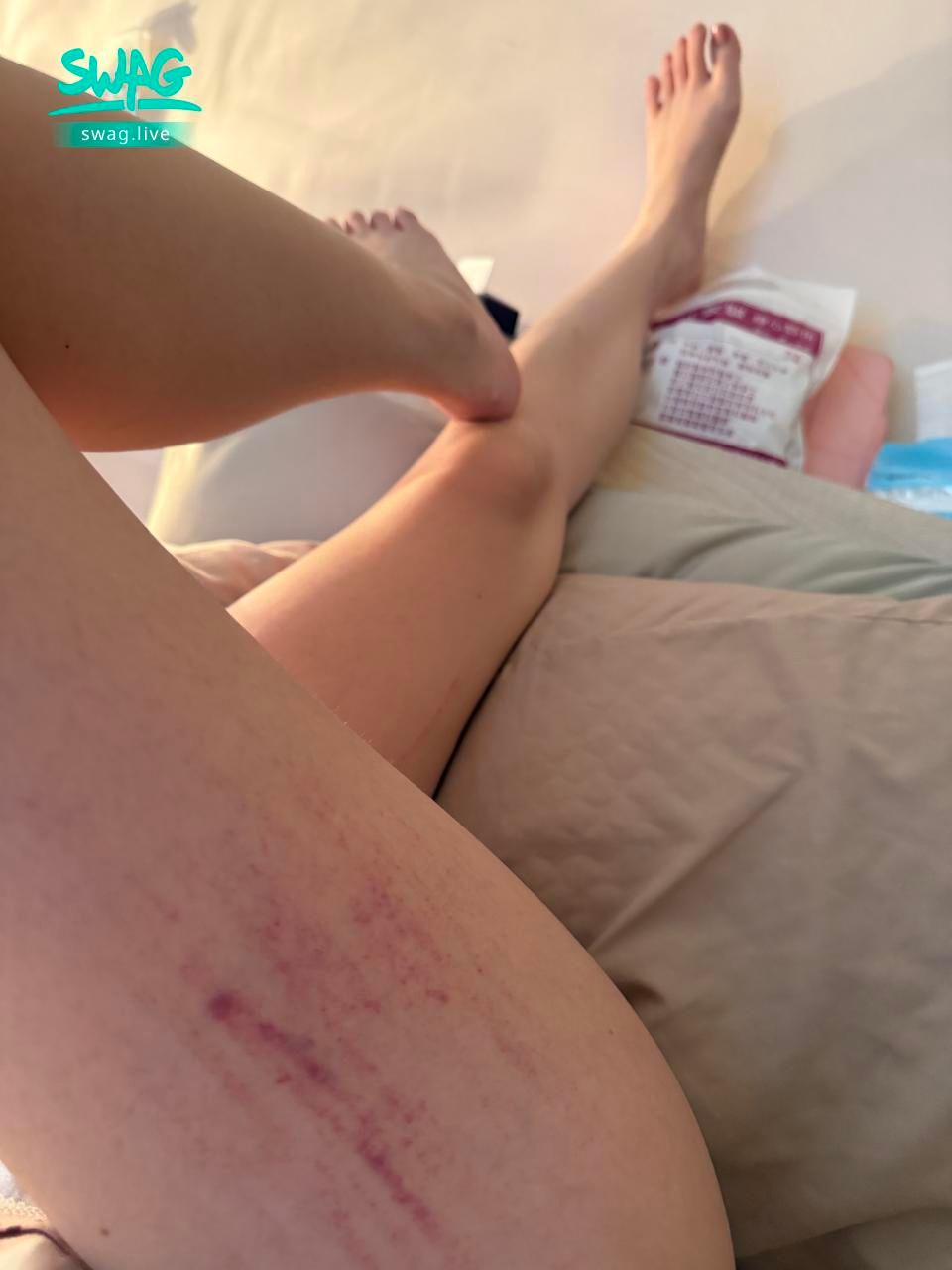 aprillady : 一直過敏 好煩唷😰