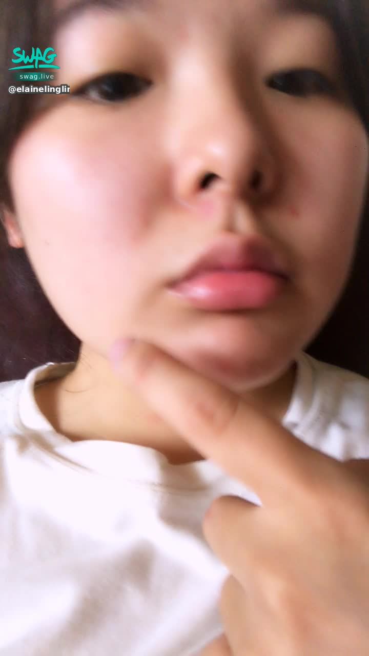  : 一個兩個三個痘痘