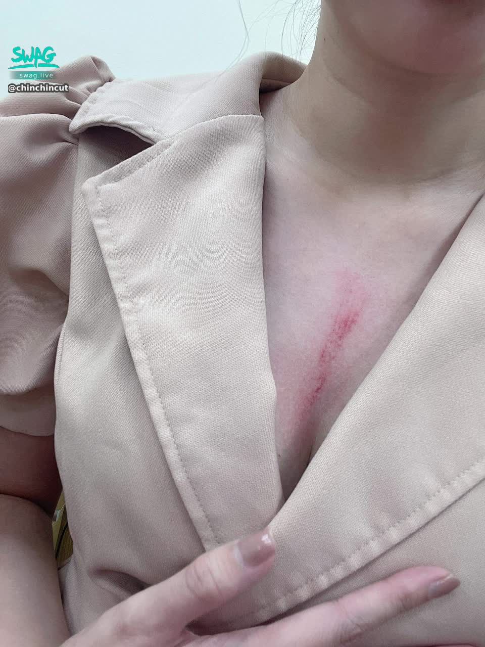 chinchincute : #too #sexy  #hurt