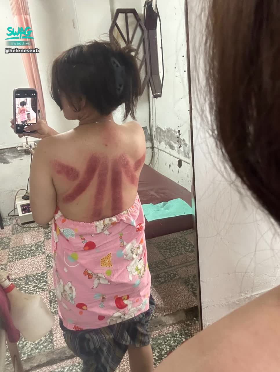 helenesexbaby : 這個背好多朋友都以為我被揍了
不是啊啊~~就是滑罐濕氣很重😓