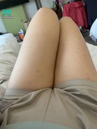 : Want to open up your peach legs?