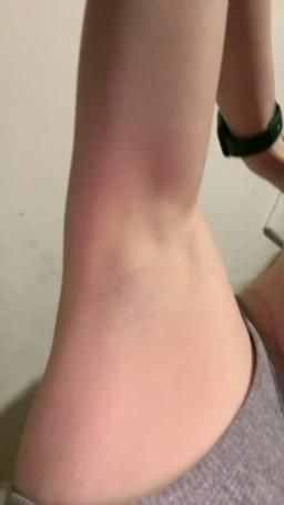 sweetkatty : my armpits