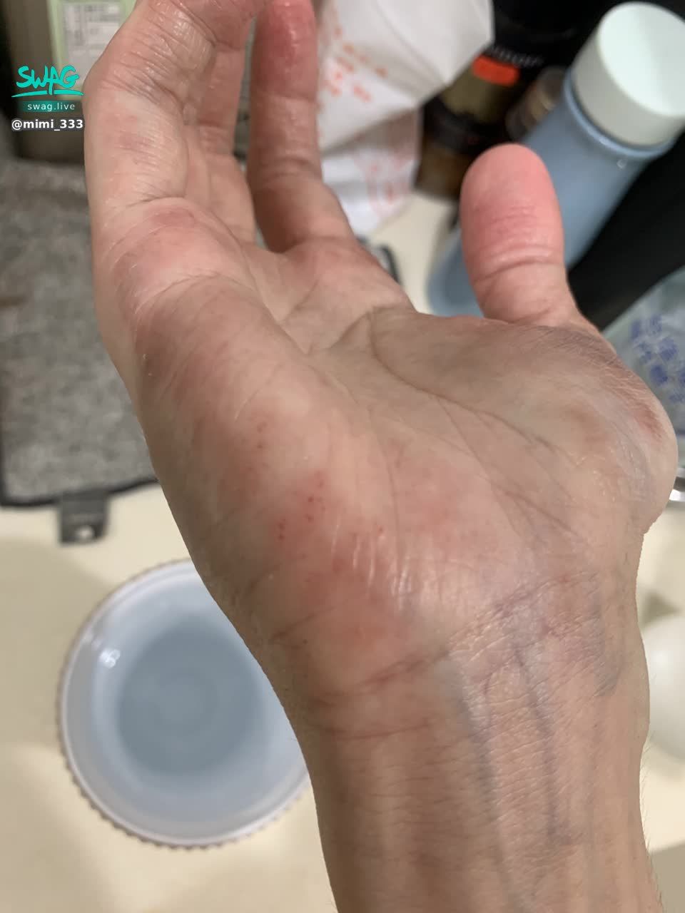 mimi_333 : 謝謝眾愛卿如此關心我的身體
給你們看看👀我的過敏發炎症狀比上週好多了～
雖然今天上線前又抓破了一陣
希望後續能持續穩定

謝謝kit kat入場卷支援💓💓💓💓💓💘
沒有熱舞的表演你們依舊讓我感到如此有底氣
真是
《心動拍拍》了啦