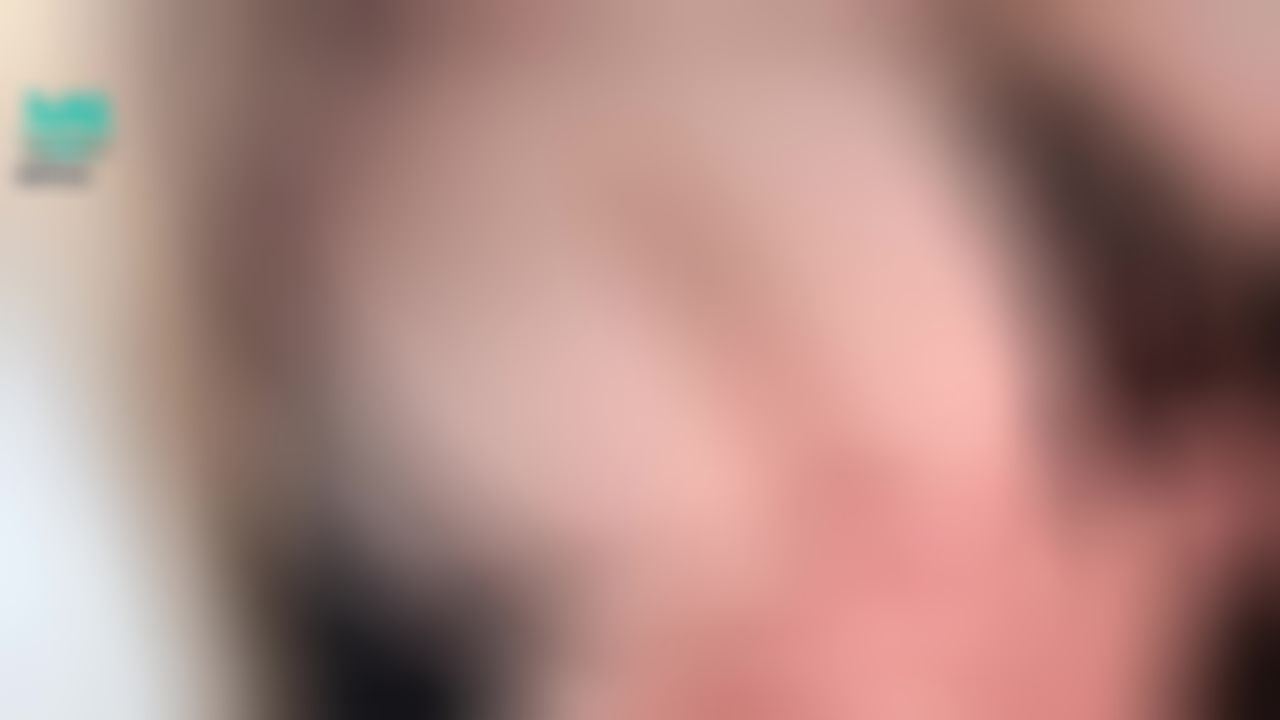  : 