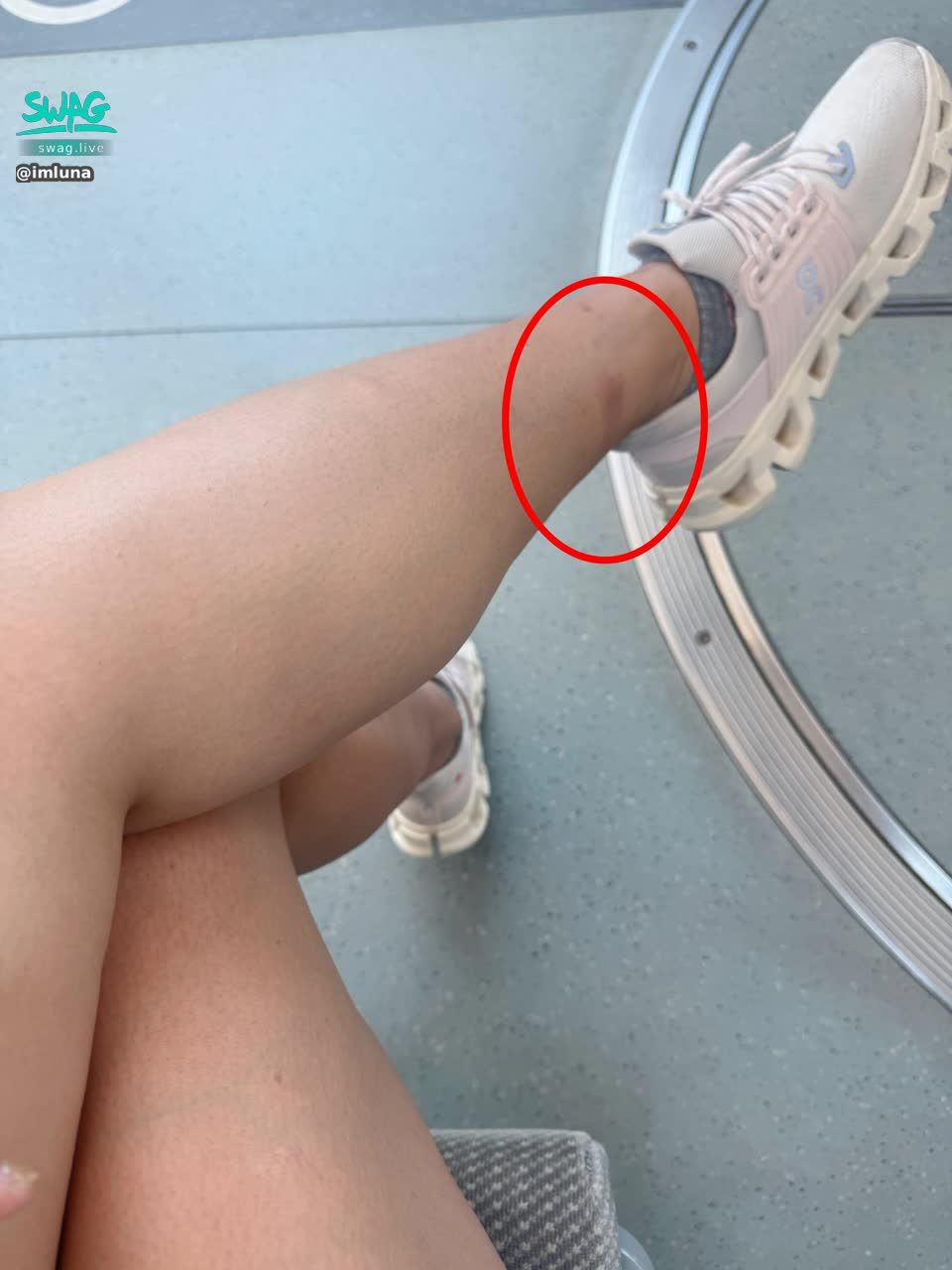 imluna : 牽車時撞一個超大力 超痛的啦😢