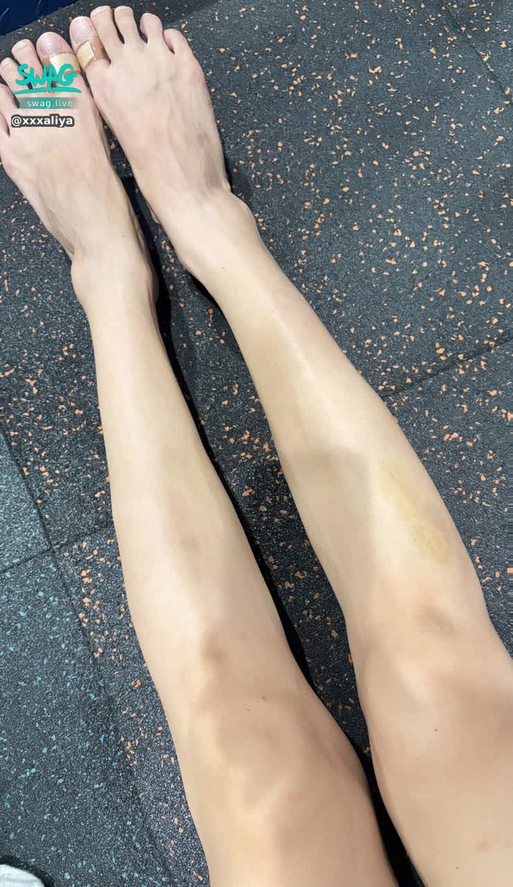 xxxaliya : 前幾天爬到櫃子上拿東西摔下來
把腿摔的鼻青臉腫😞