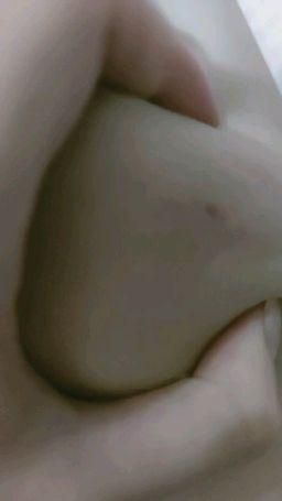 floraof : 有點似乳頭。。。。。大腿的蚊咬🤣