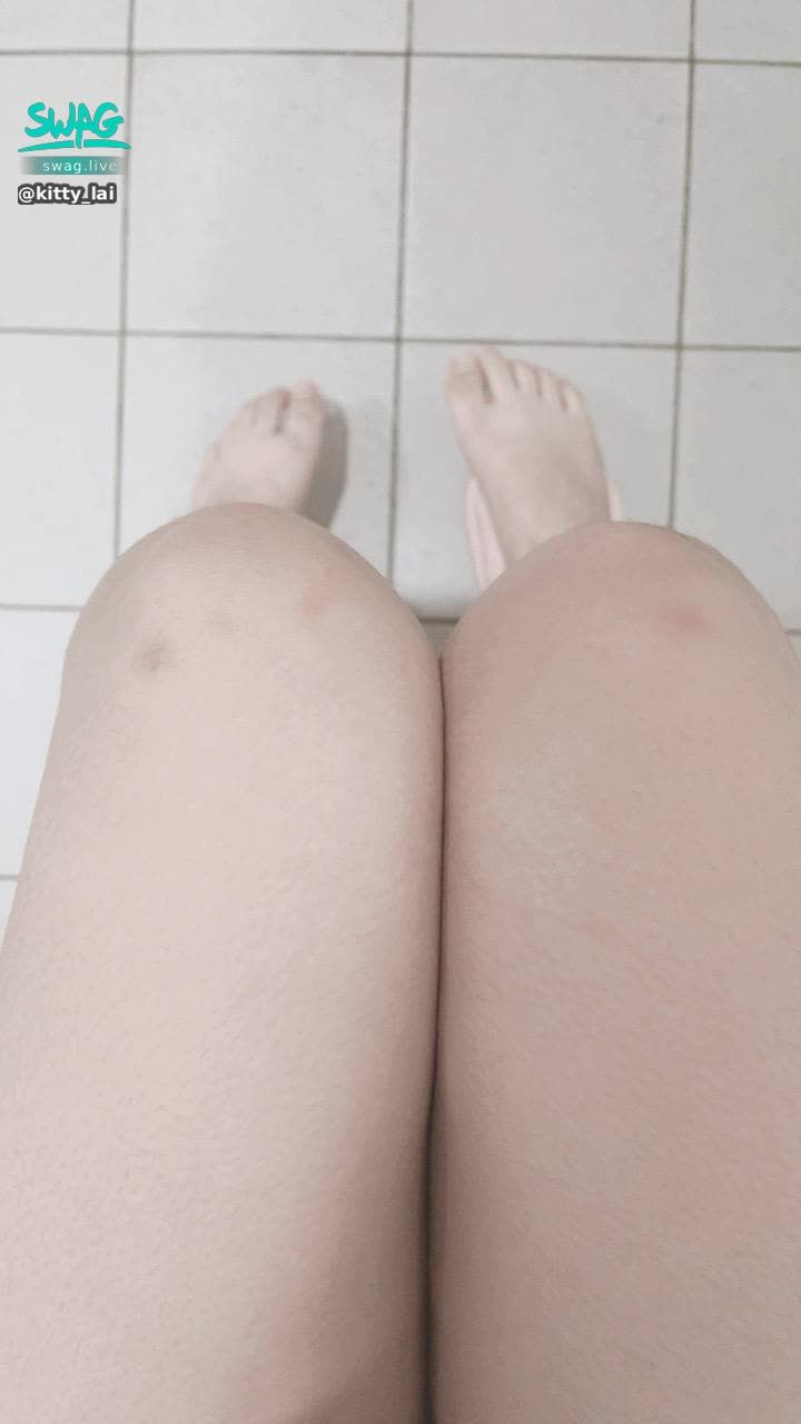 kitty_lai : 越來越多瘀青了⋯討厭🥲
